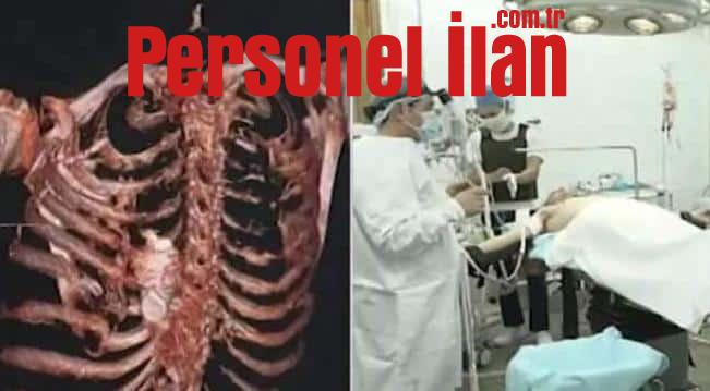 Tıp Dünyasını Şaşkına Çeviren Vaka! Patlasaydı Doktorlar da Ölürdü