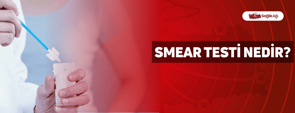 smear