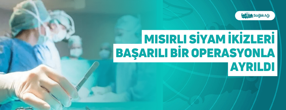 Mısırlı Siyam İkizleri Başarılı Bir Operasyonla Ayrıldı