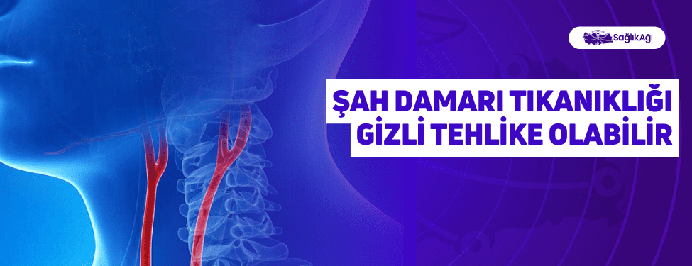 Şah Damarı Tıkanıklığı Gizli Tehlike Olabilir