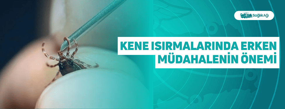 Kene Isırmalarında Erken Müdahalenin Önemi