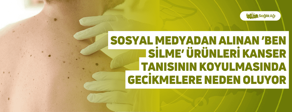 Sosyal Medyadan Alınan ’Ben Silme’ Ürünleri Kanser Tanısının Koyulmasında Gecikmelere Neden Oluyor