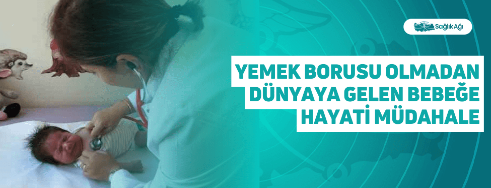 Yemek Borusu Olmadan Dünyaya Gelen Bebeğe Hayati Müdahale
