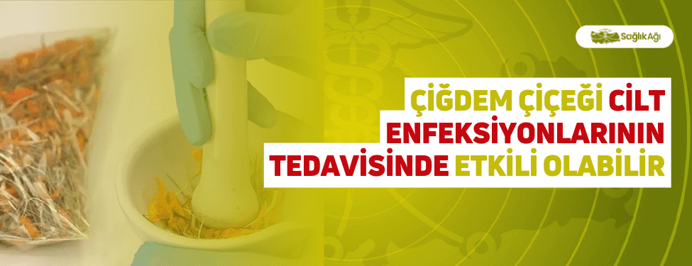 Çiğdem Çiçeği Cilt Enfeksiyonlarının Tedavisinde Etkili Olabilir