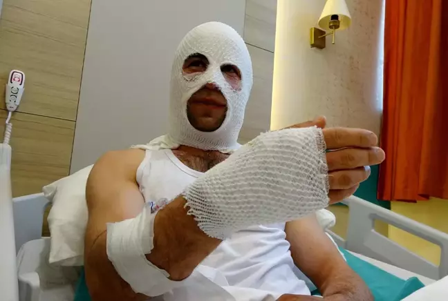 Nişanlısı İçin Hazırlık Yaparken Korkunç Kaza: "Spreyi Isıtayım Derken Ev Havaya Uçtu!"