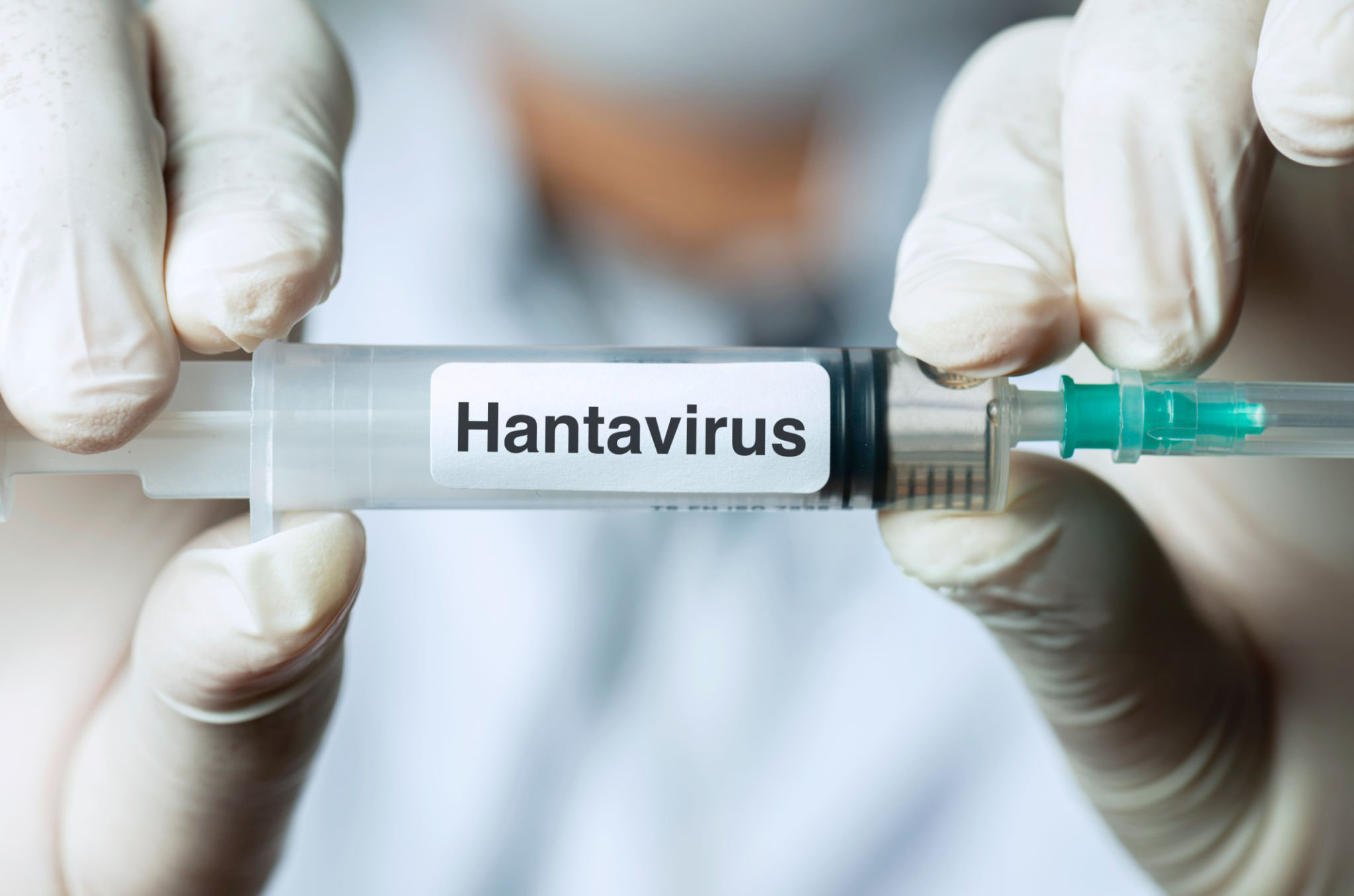 Uzmanlar, hantavirüs enfeksiyonunun yüksek ateş ve halsizlik gibi belirtilerle gribe